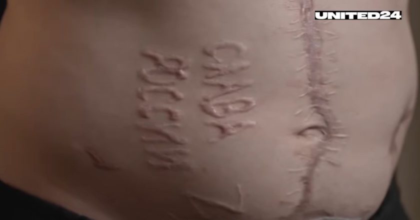 聯國爆俄凌虐烏戰俘 蘇聯時代手法烙印「打電話給普亭」